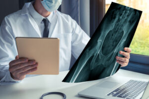 Doctor examining x-ray of the hip