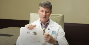 dr thomas describing reverse total shoulder replacement