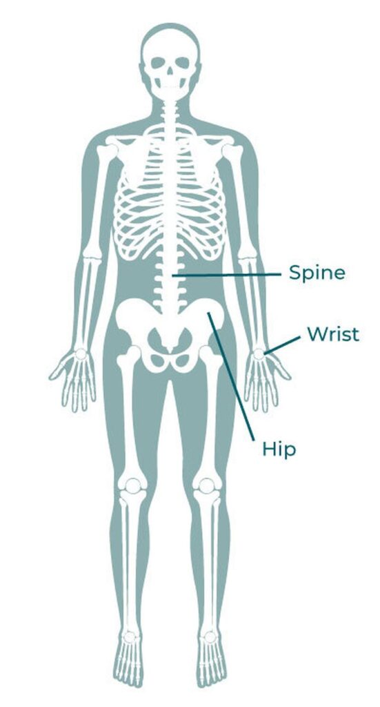 Skeleton Image